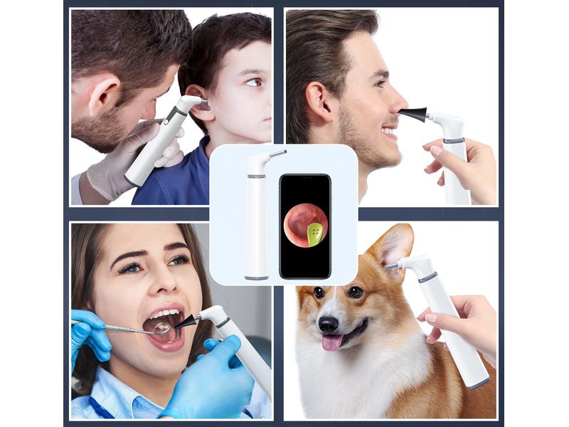 Teslong Smart Otoscope WiFi otoskop pro kontrolu a čištění ucha