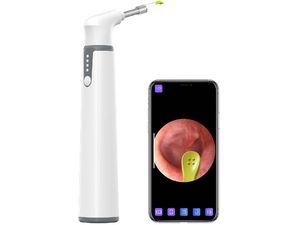 Otoscop verificare și curățare urechi Teslong Smart Otoscope Wi-Fi 